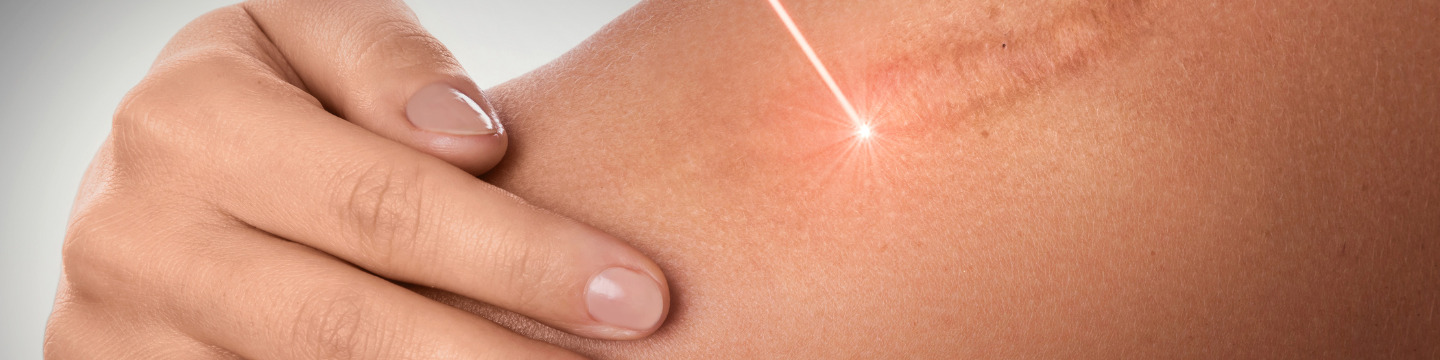 Laser_websim4 Laser_websim4